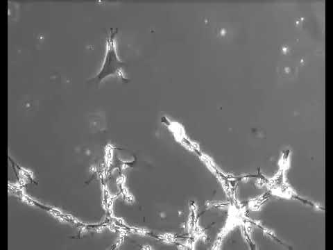 cómo se denomina la comunicación entre dos neuronas