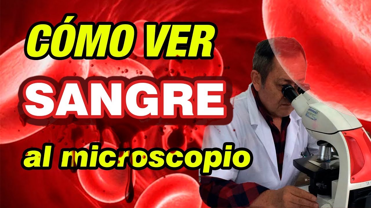 muestra de sangre en el microscopio