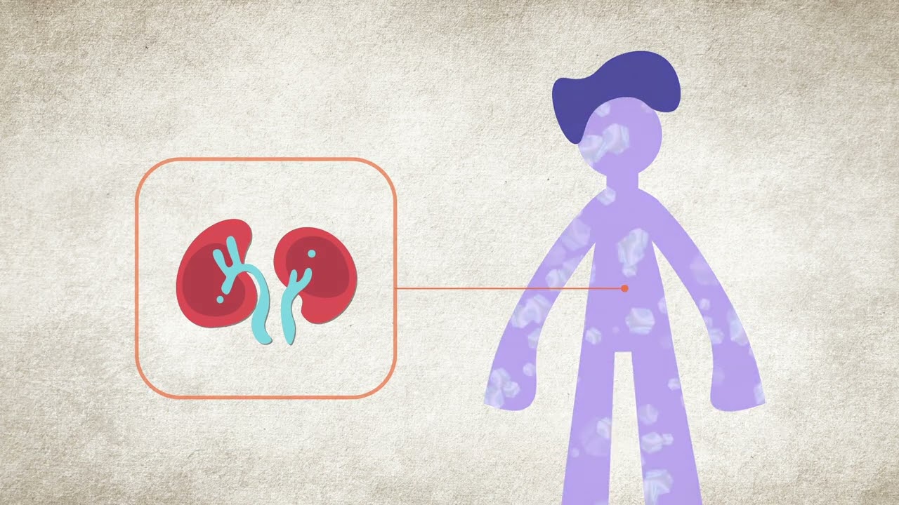 exceso de hidrógeno en el cuerpo humano