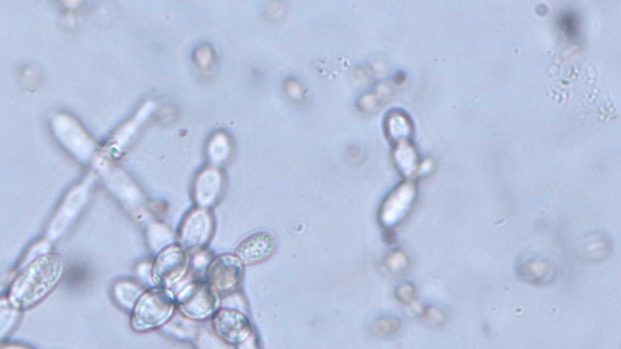 bacterias descomponedoras de materia organica