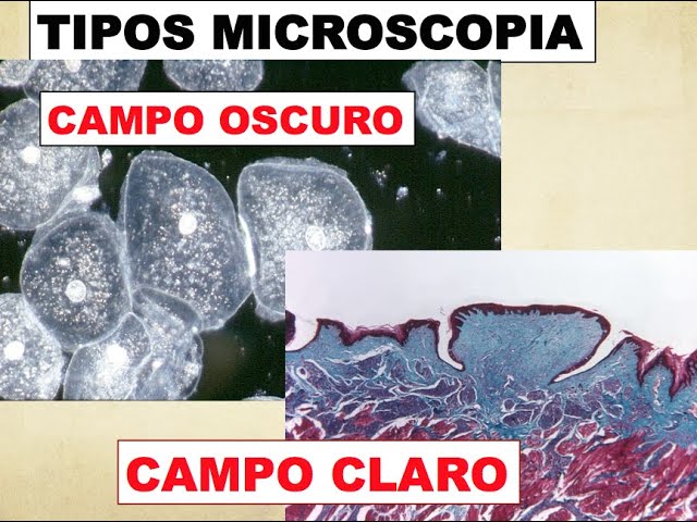 campo claro y campo oscuro microscopio