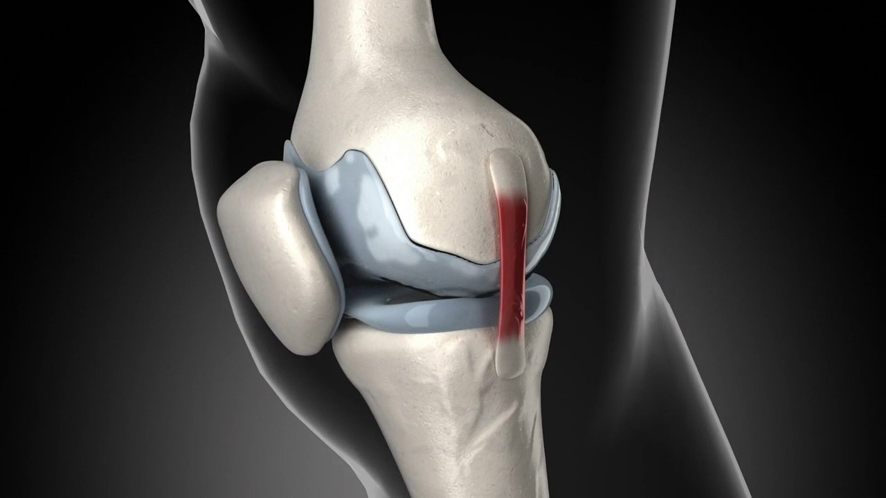 nombres de las partes de la rodilla