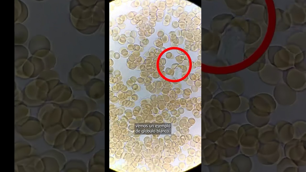 como se ven las bacterias en el microscopio