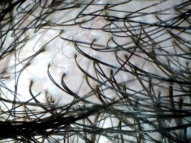 como se ve un cabello en el microscopio