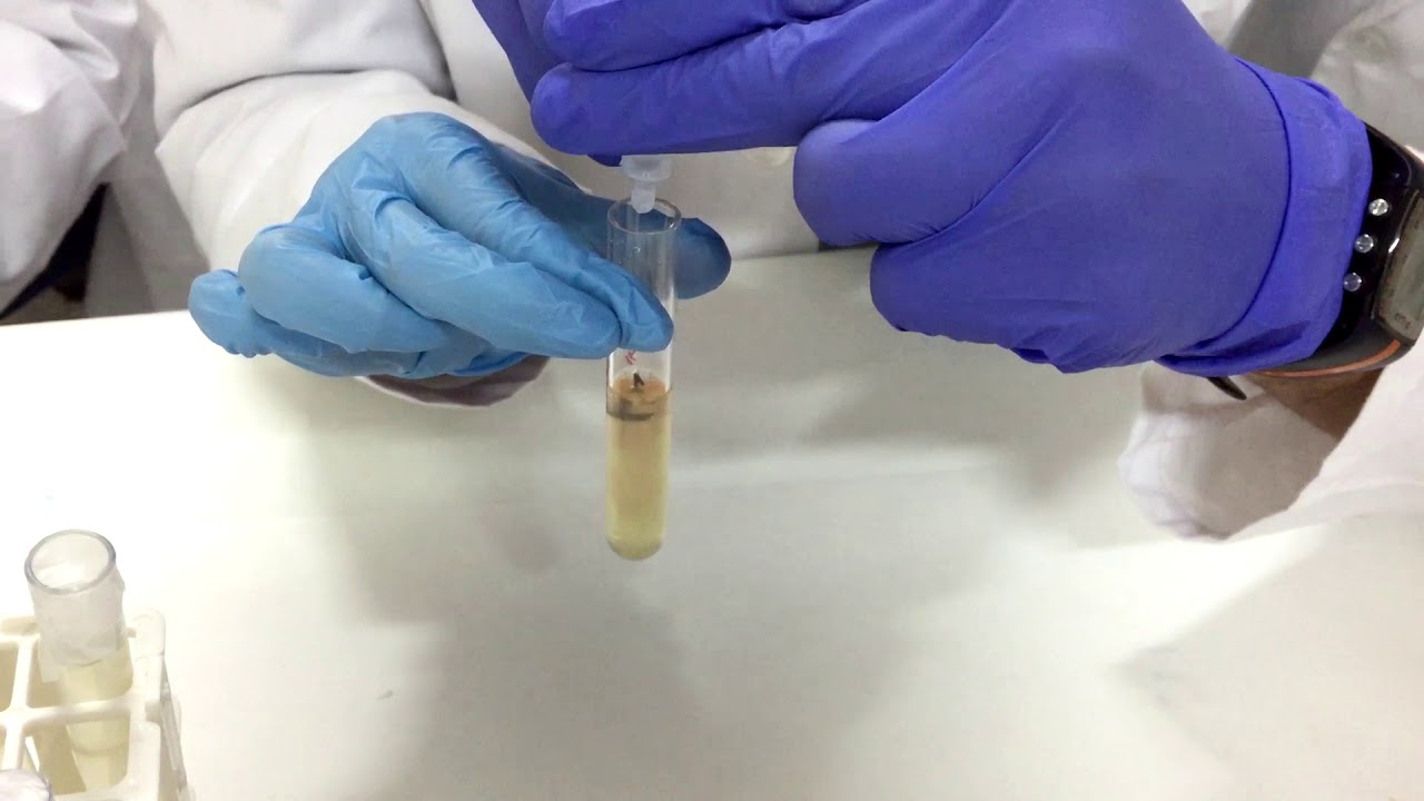 reduccion de nitratos a nitritos microbiologia