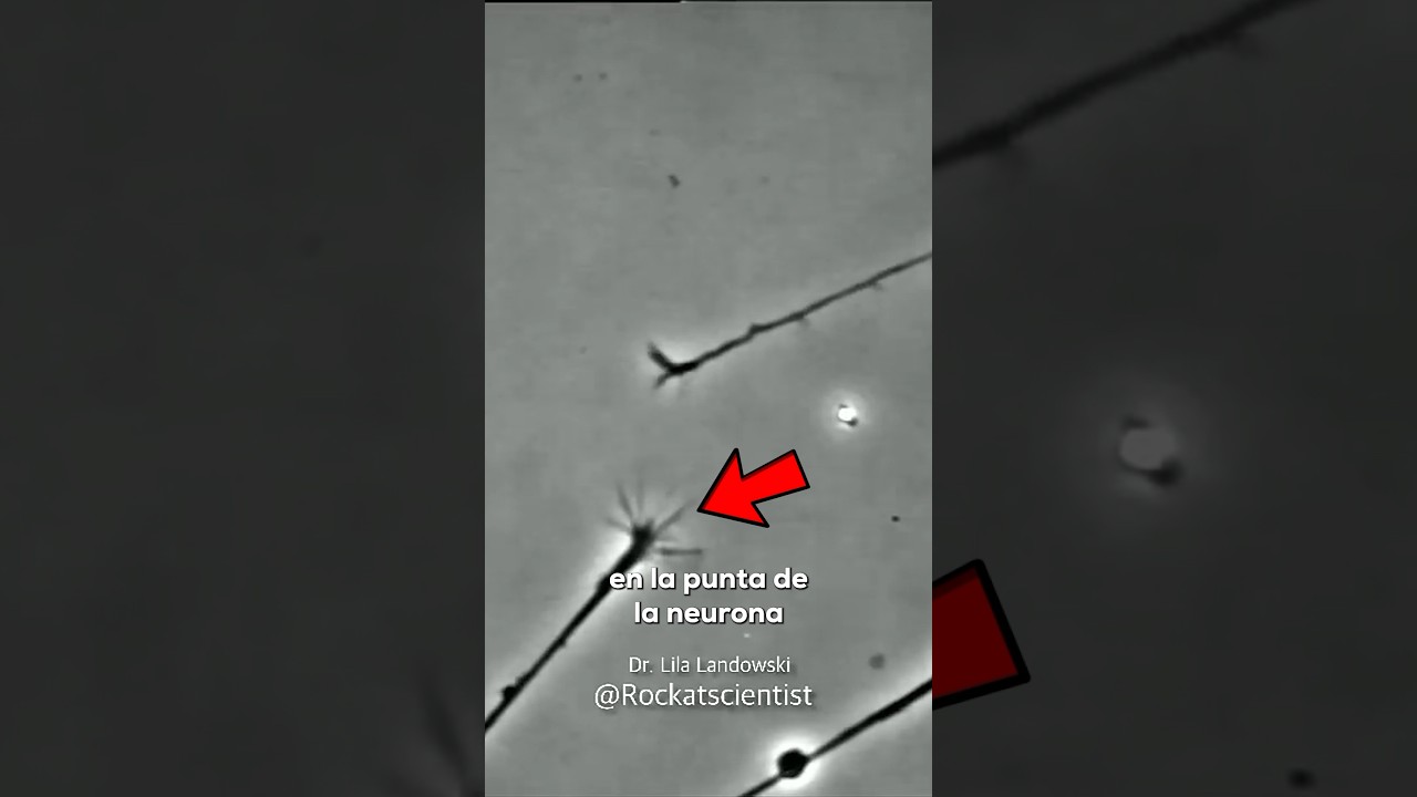 region de la neurona muy ramificada y relativamente corta